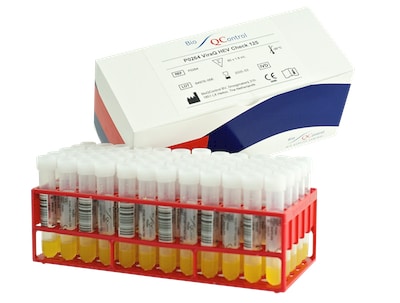 viraq20check20controls20for20parvo20b19v-hav20and20hev20nat20assays-jpg