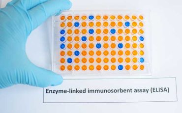 Enzyme-linked Immunosorbent Assay Principle and Elisa Test Procedures.